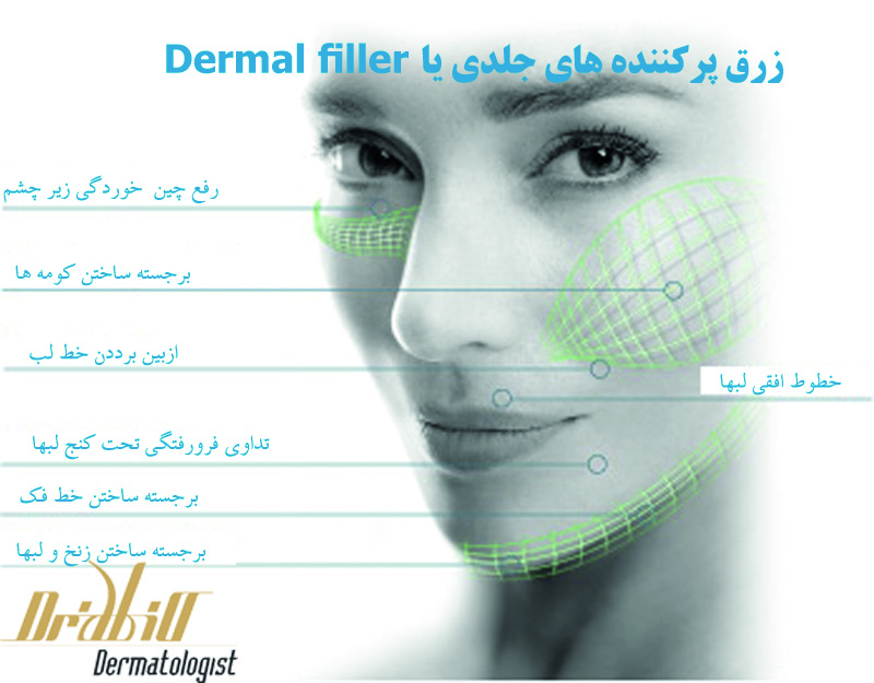 Fillers