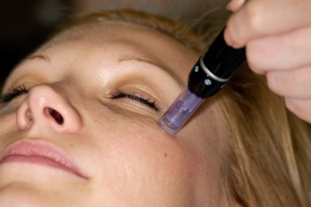 Dermapen