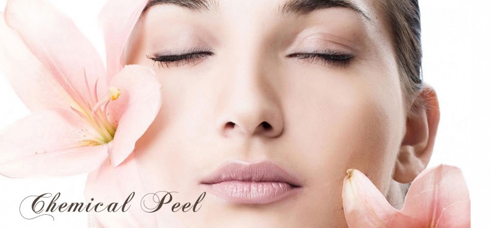 Chemical Peel